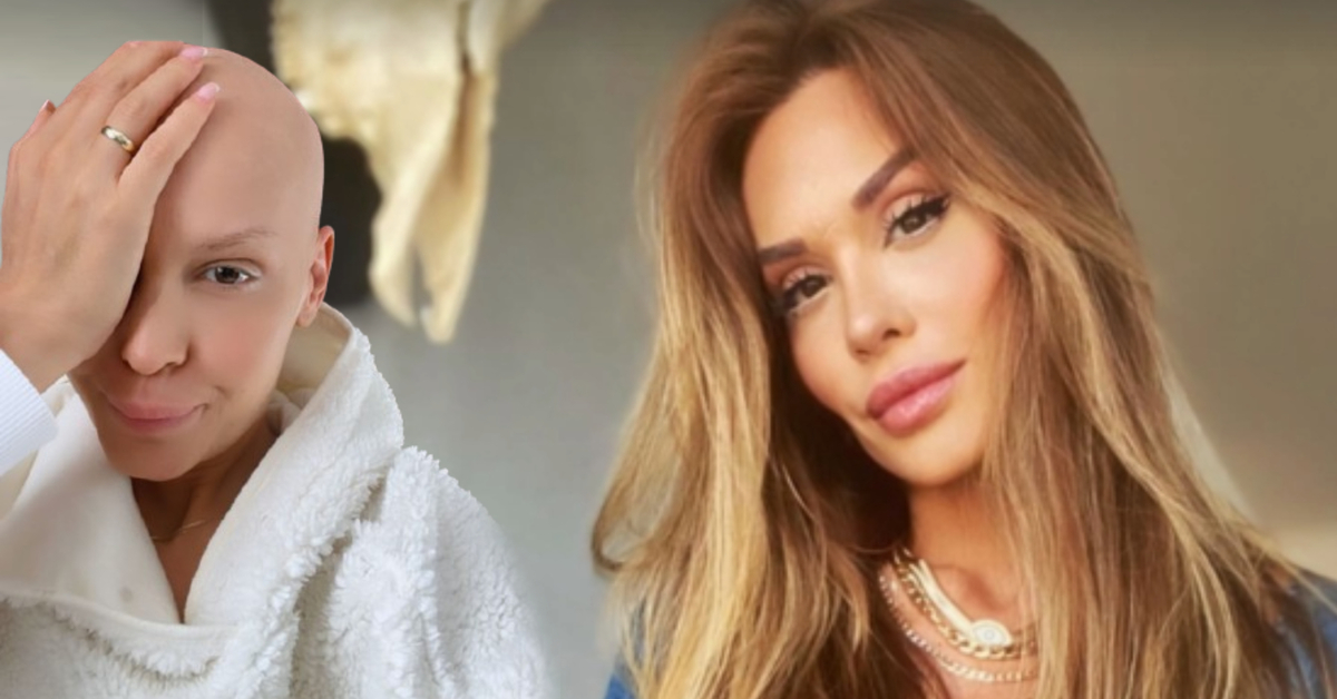 Şimal son halini paylaştı: Tek fark kel olmam